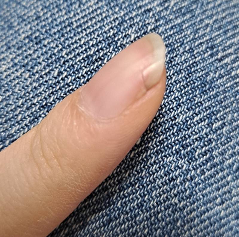 손톱 자르는게 맞겠지..복구안되나.. | 인스티즈