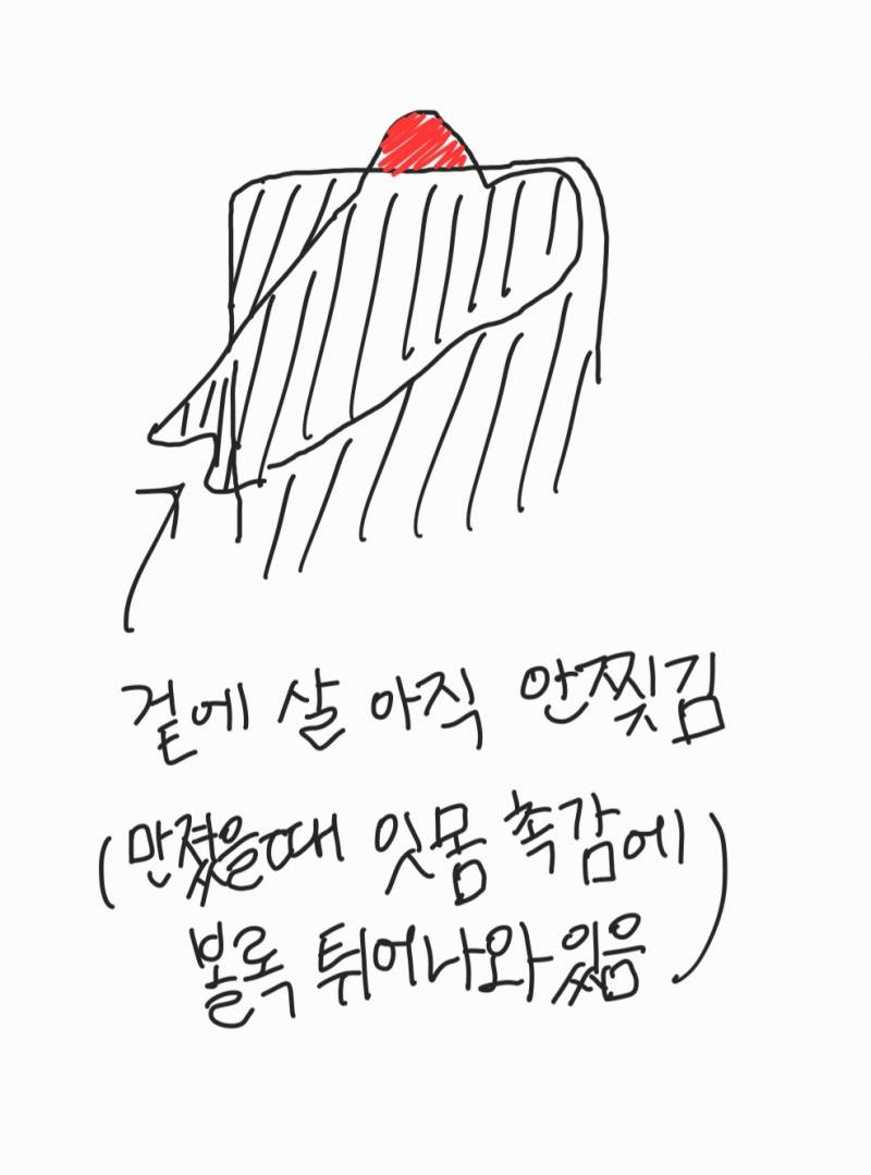 나 윗쪽 사랑니 지금 상태가 이런데 어떻게 생각해..? | 인스티즈