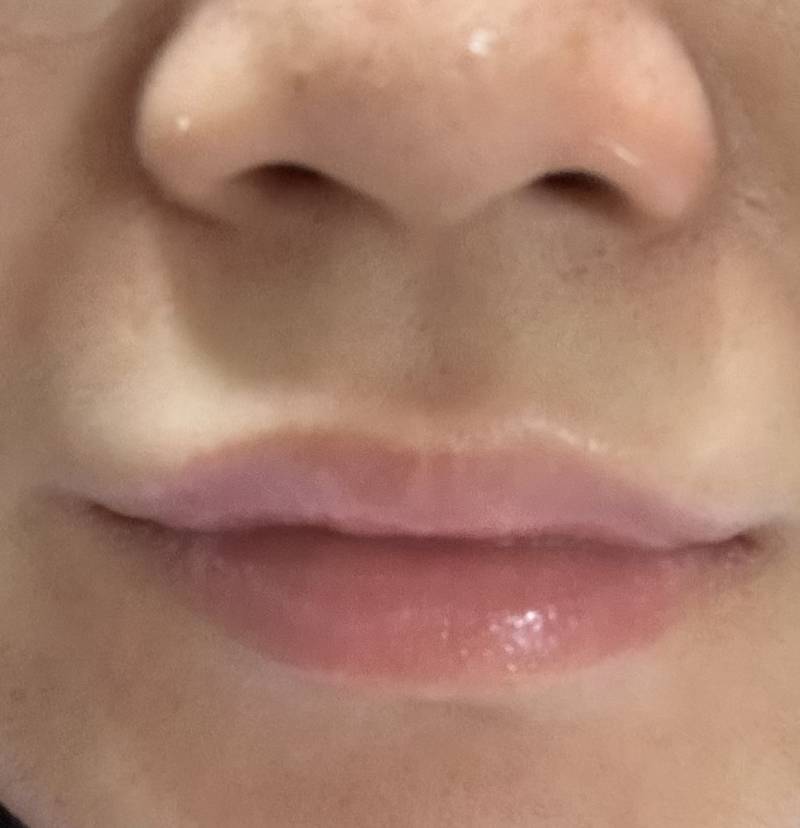 오늘 데이트 있어서 입술 각질 정리 좀 해봤다ㅎ | 인스티즈