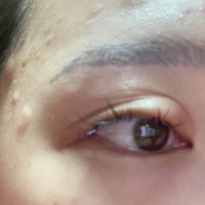 나 몸 ㄹㅈㄷ 불편한 거 다 달고 있는데 그중 최고가 ㅎㅇㅈㅇ | 인스티즈