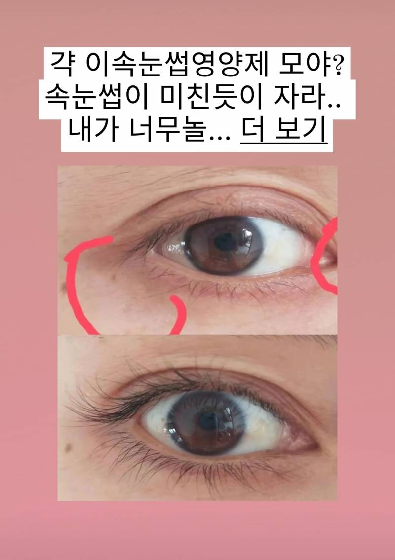 얘들아 영양제하나로 이게가능해? | 인스티즈