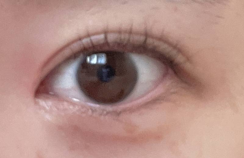 나진짜 쌍수 이렇게 다시하고싶어.. 😞 | 인스티즈