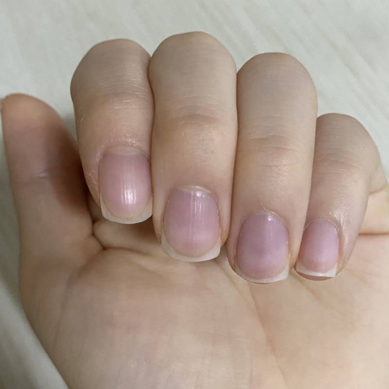 네일샵 자주 가는 익들아‼️ 내 손톱 이런데 케어+영양제 받으러 갈까?? | 인스티즈