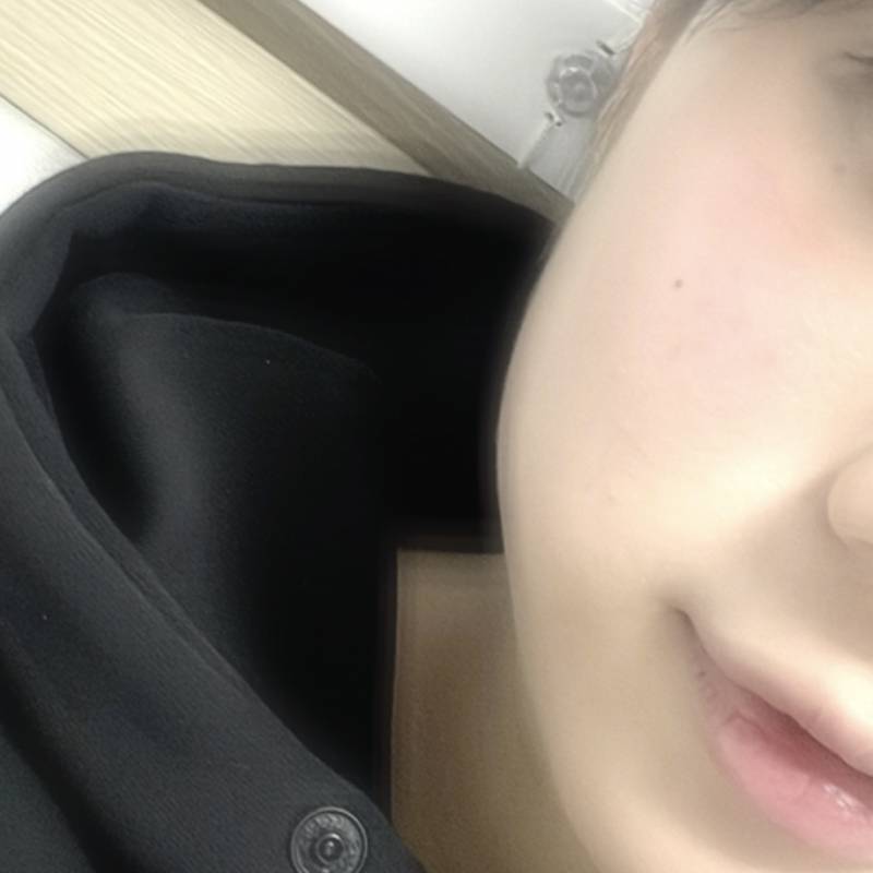 와 누가 사랑니 뽑는거 안아프대… 나 오늘 천국가서 예수님이랑 하이파이브하고 옴… | 인스티즈