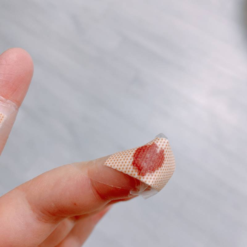 나 칼에 살점 베여서 피 지근 5분 넘게 나는데 괜찮은가야??..혐오주의 | 인스티즈