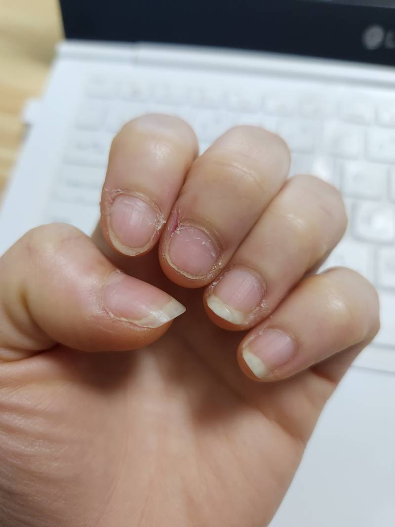 나 담주에 해외여행 가는데ㅜ 손톱 덜 길었거든 네일 할까말까ㅜㅜ | 인스티즈