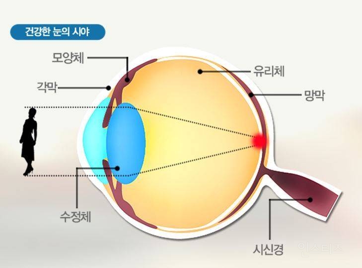 현모양처는 못됐네, 박연진. (더글로리 연진이도 색약일 가능성이 높은 이유) | 인스티즈