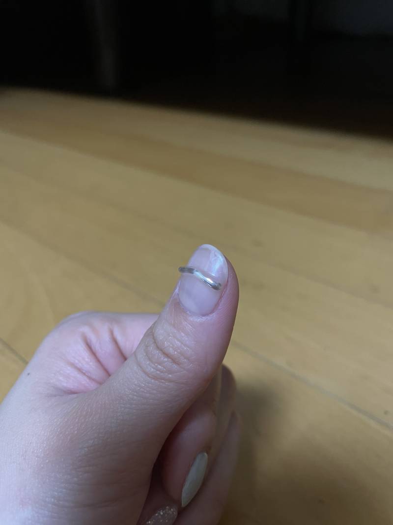 나 토요일에 네일 받았는데 엄지손톱 깨졌어..이거 뭐 어떻게 못하지? | 인스티즈