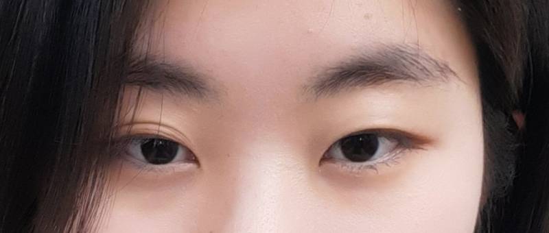 쌍수 할말 조언좀 | 인스티즈