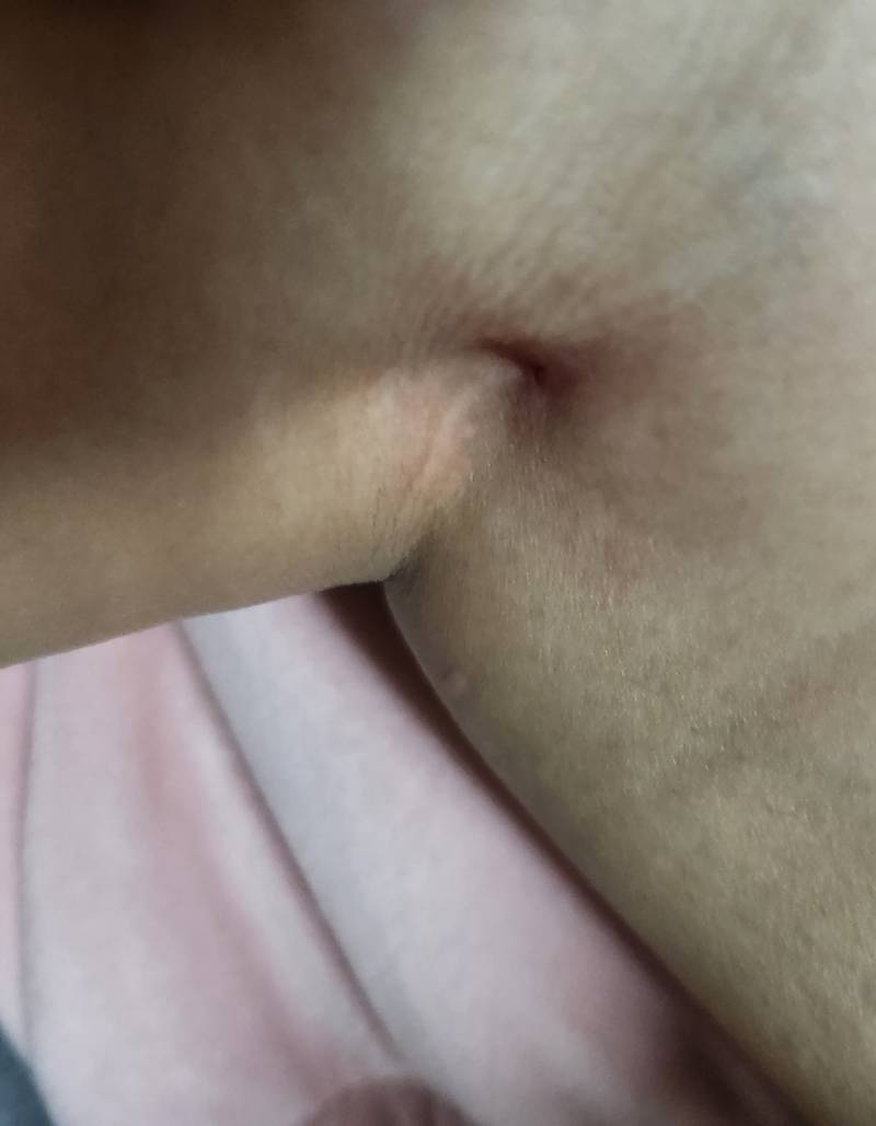 고양이때문에 무릎 사이에 구멍났는데 어캄?... | 인스티즈