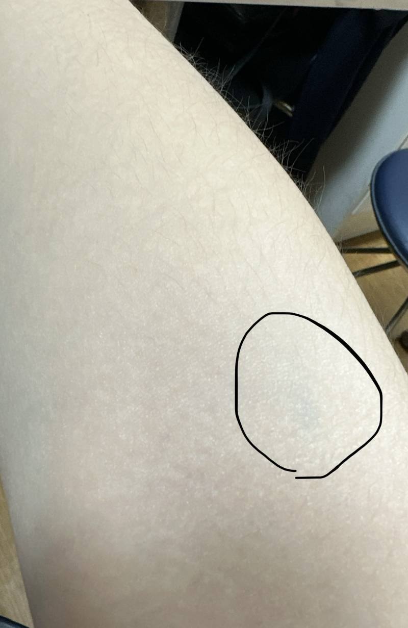 간호익들아 왜 여기다 주사 놓으면 안돼? | 인스티즈