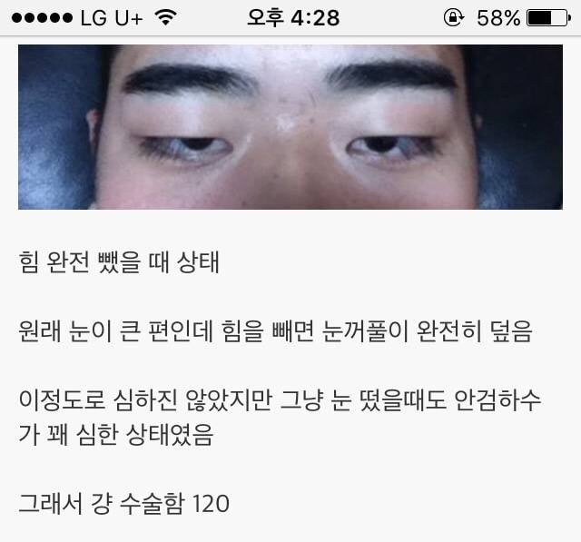 쌍커풀 수술로 제2의 인생을 사는 남성분들.jpg | 인스티즈