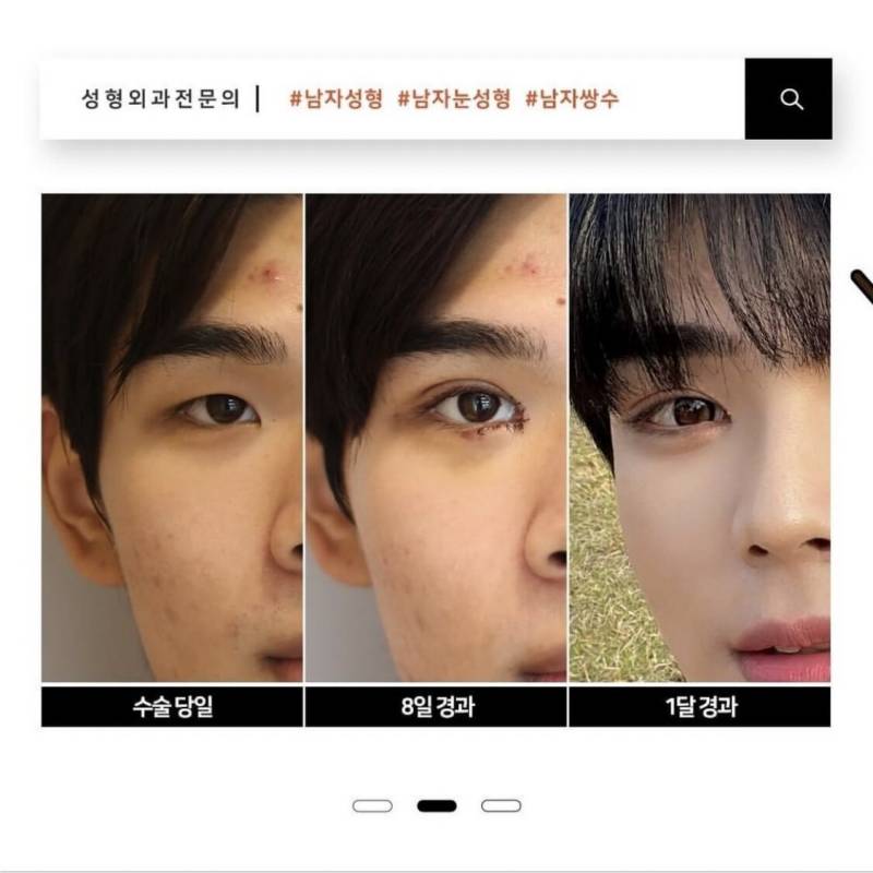 쌍커풀 수술로 제2의 인생을 사는 남성분들.jpg | 인스티즈