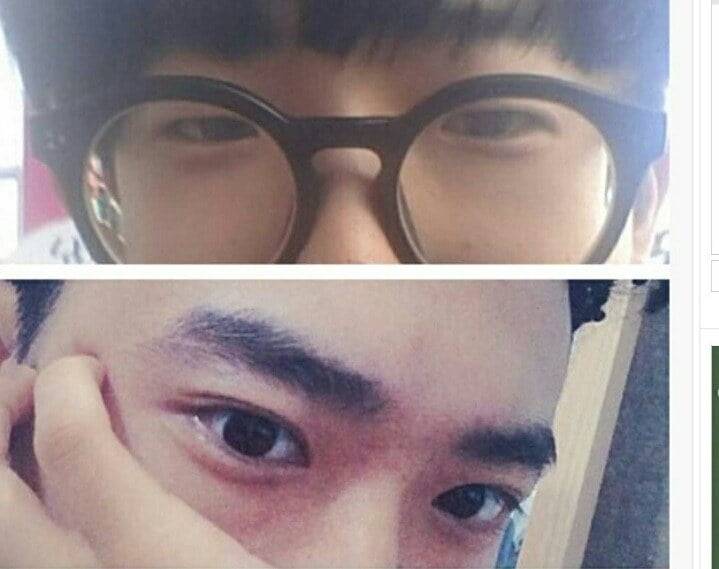 쌍커풀 수술로 제2의 인생을 사는 남성분들.jpg | 인스티즈