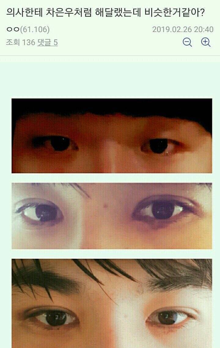 쌍커풀 수술로 제2의 인생을 사는 남성분들.jpg | 인스티즈