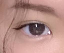 [잡담] 원래 쌍꺼풀 있는데 안검하수 때문에 눈매교정 했거든 | 인스티즈
