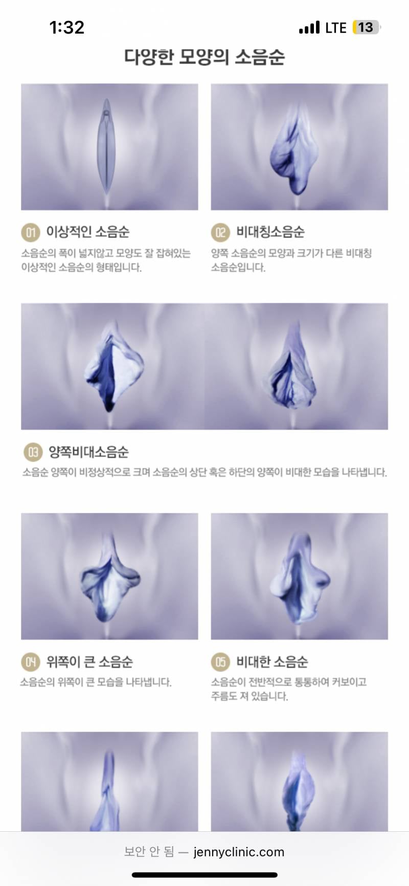 [잡담] 내 소음순 3번 모양인데 이상한거였음? | 인스티즈