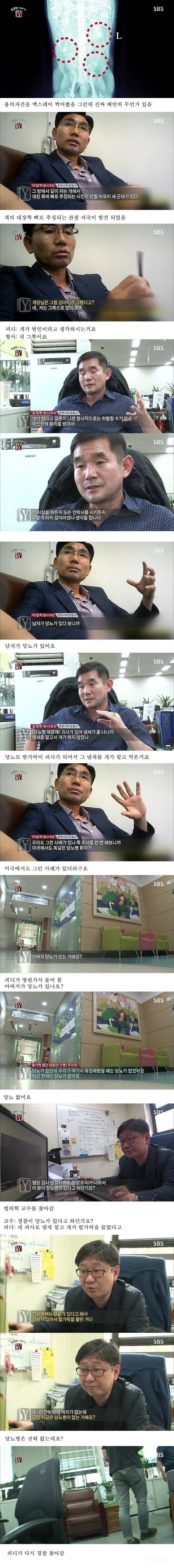 약혐주의) 자고 일어나니 한쪽 발가락이 모조리 사라진 기괴 그자체인 사건 | 인스티즈