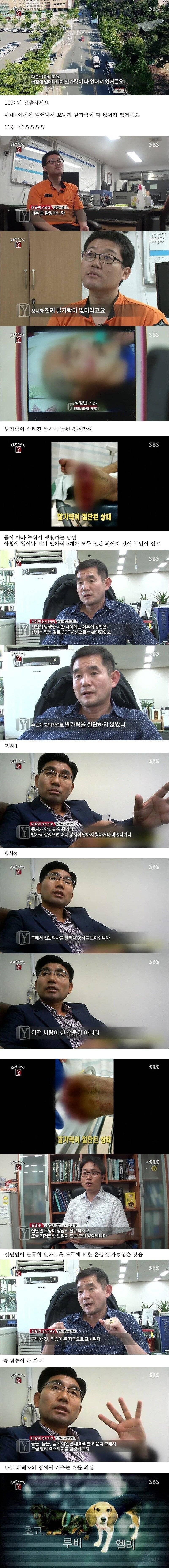 약혐주의) 자고 일어나니 한쪽 발가락이 모조리 사라진 기괴 그자체인 사건 | 인스티즈