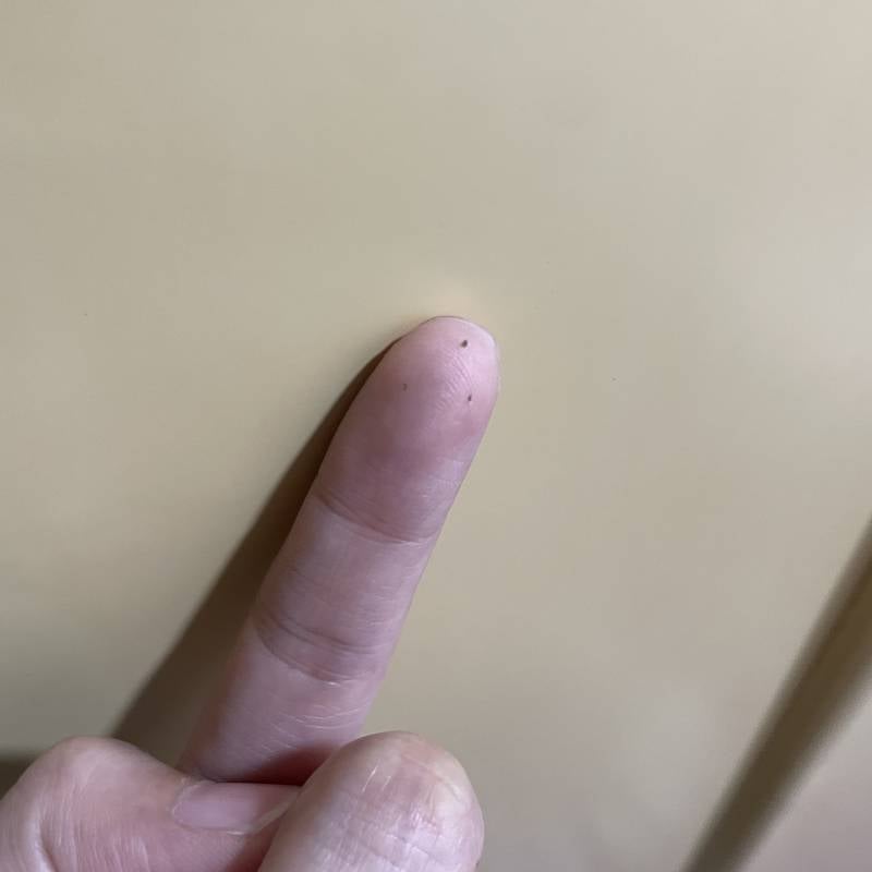 [잡담] 밀가루 식초로 점 빼기! 후기 | 인스티즈