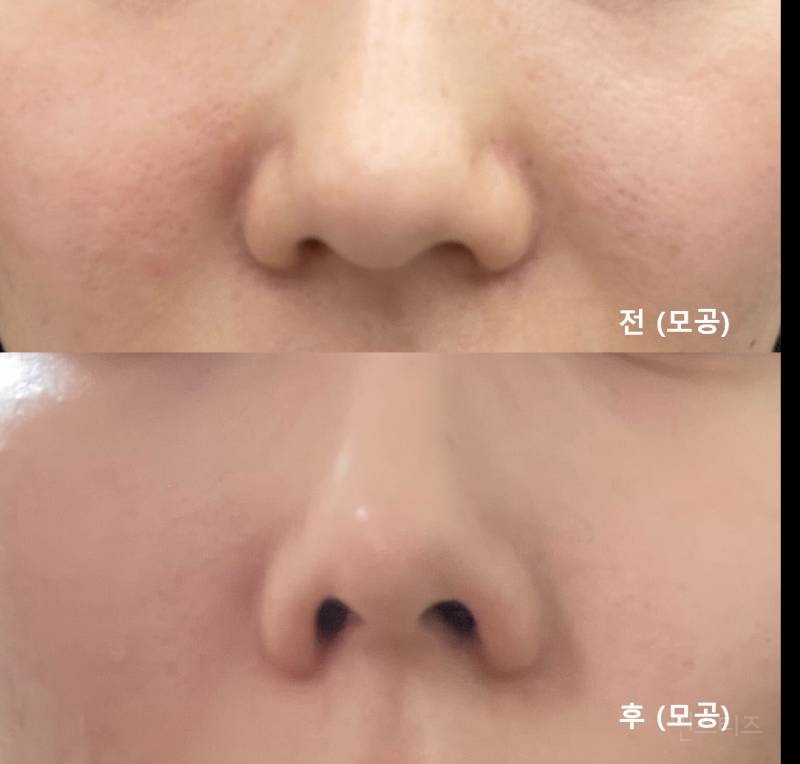 화장품 다이어트 정리해줄게 (제품 추천 있) | 인스티즈