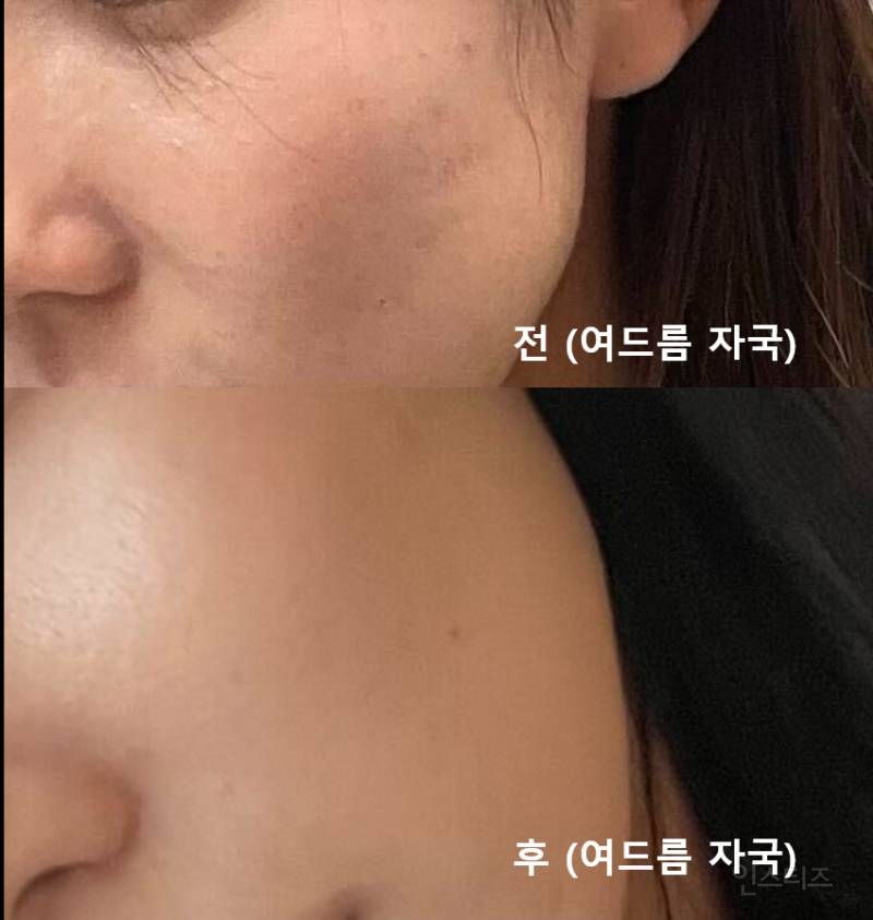 화장품 다이어트 정리해줄게 (제품 추천 있) | 인스티즈