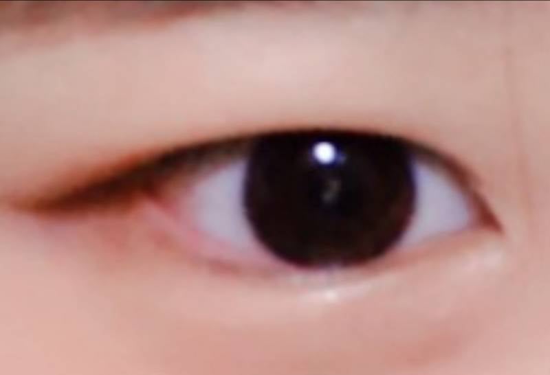 후기) 쌍수 인라인, 아웃라인 둘다해본 후기 | 인스티즈