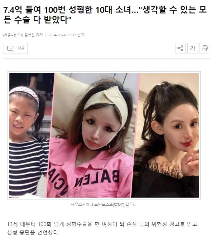 7.4억 들여 100번 성형한 10대女 뇌손상 경고 ㄷㄷㄷ | 인스티즈