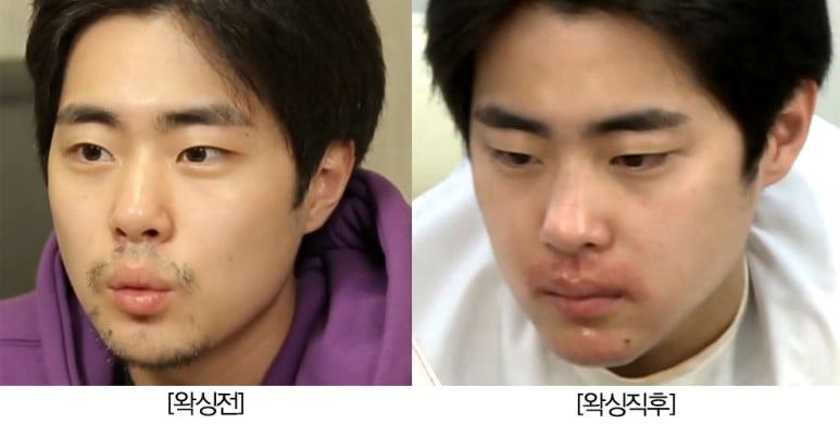 [잡담] 나혼산 조병규 왁싱 전후 봐.. 화남 | 인스티즈