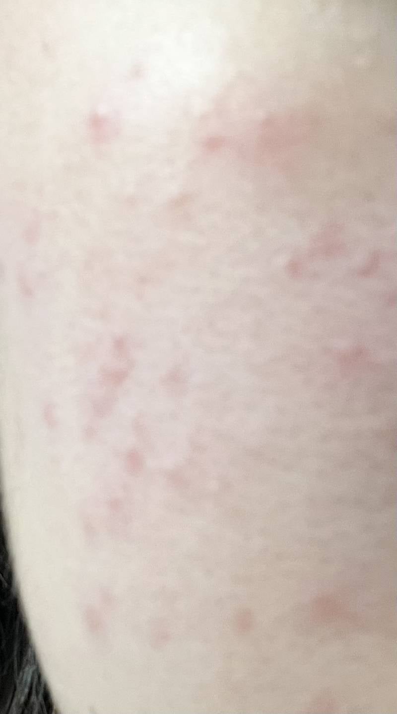 [잡담] 징짜 트러블업는 토너 없냐구.... | 인스티즈