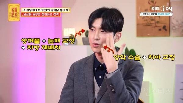 성형 수술로 변신 성공했지만 연애가 어려운 이유 | 인스티즈