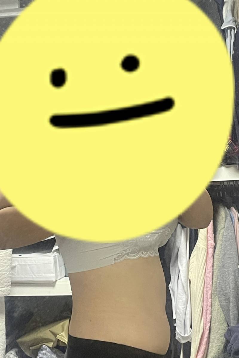 [잡담] hpl 주사 3개월차 후기 | 인스티즈