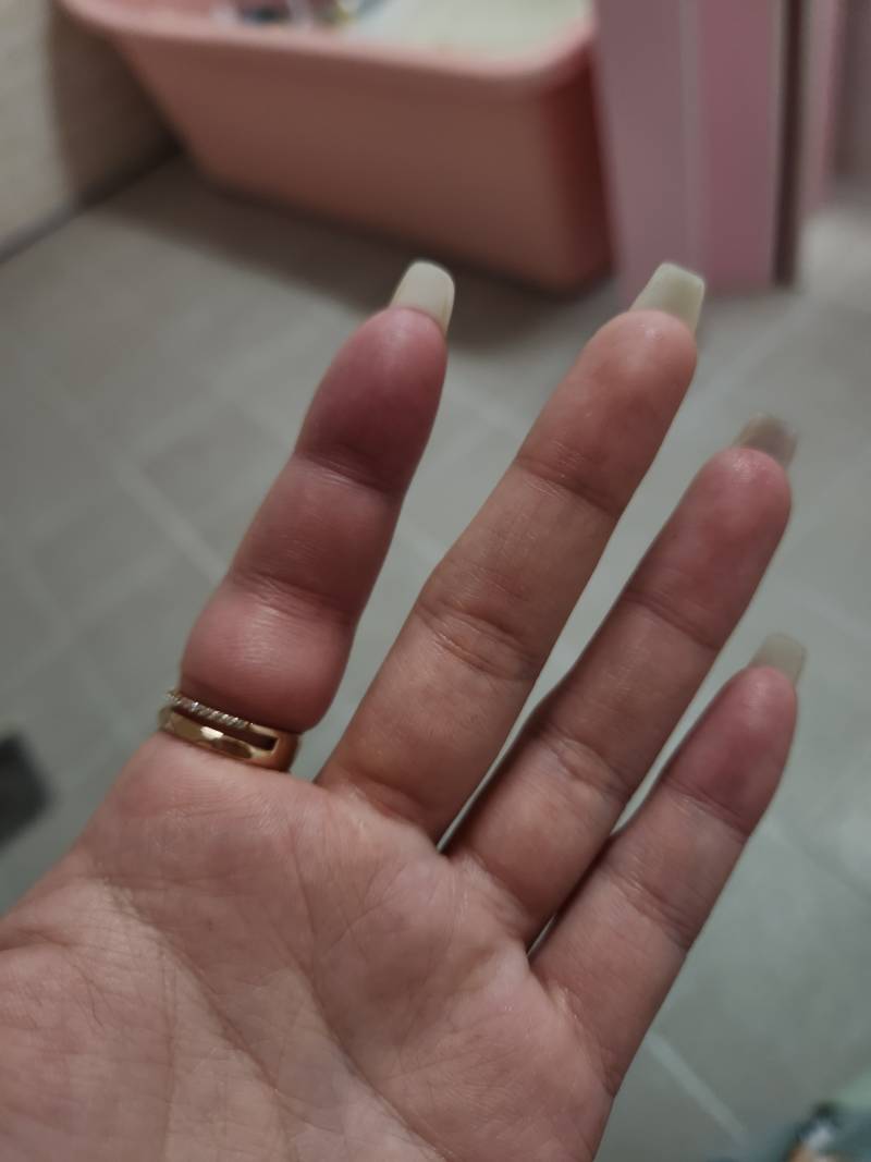 [잡담] 나 진짜 미치겠어ㅠㅠ 반지가 안빠짐 | 인스티즈