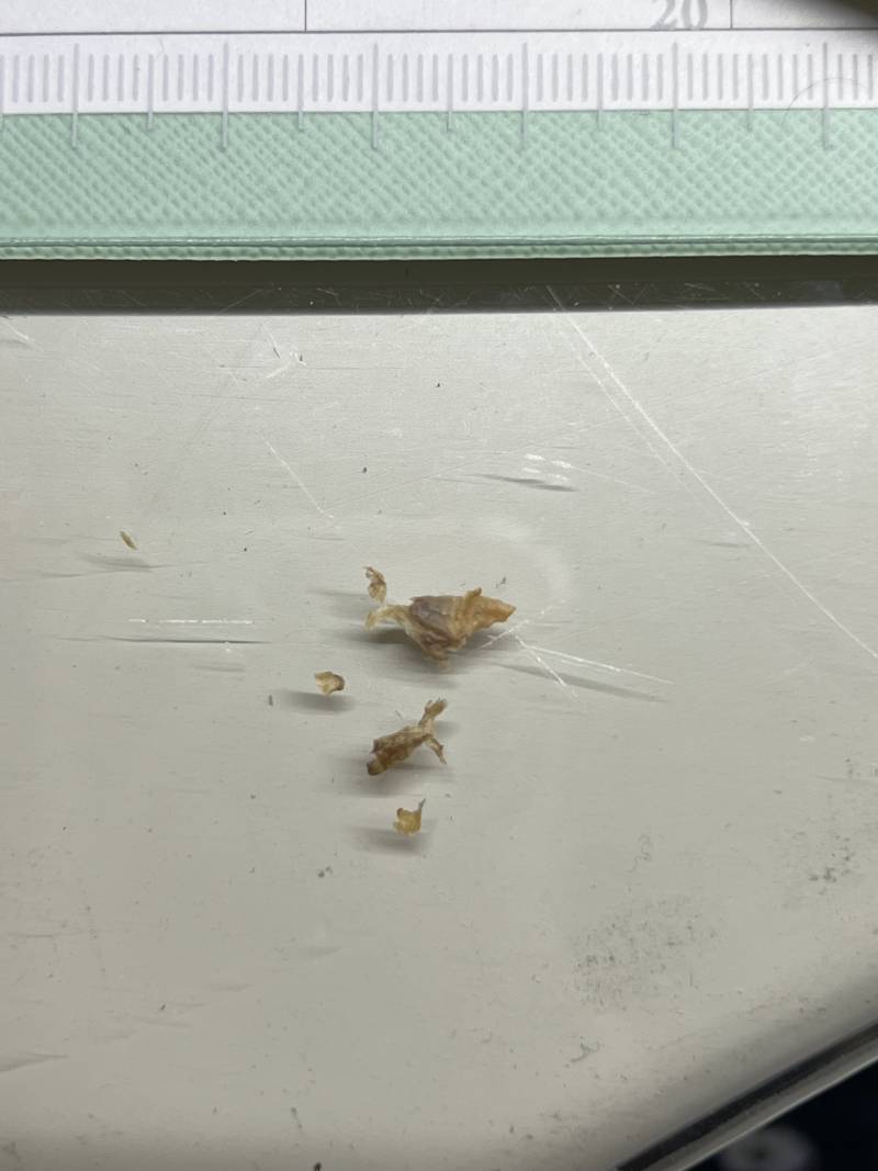 [잡담] 배꼽때 레전드 ㅎㅇㅈㅇ | 인스티즈