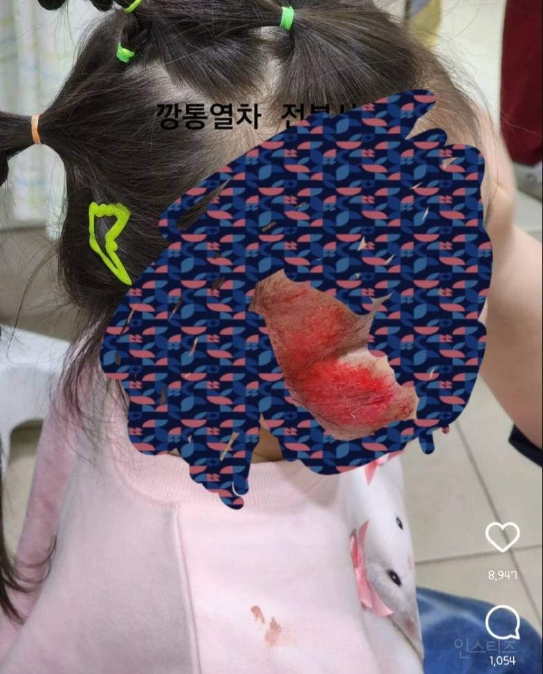 인스타에서 난리난 깡통 열차 전복 사고 (피/상처주의) | 인스티즈