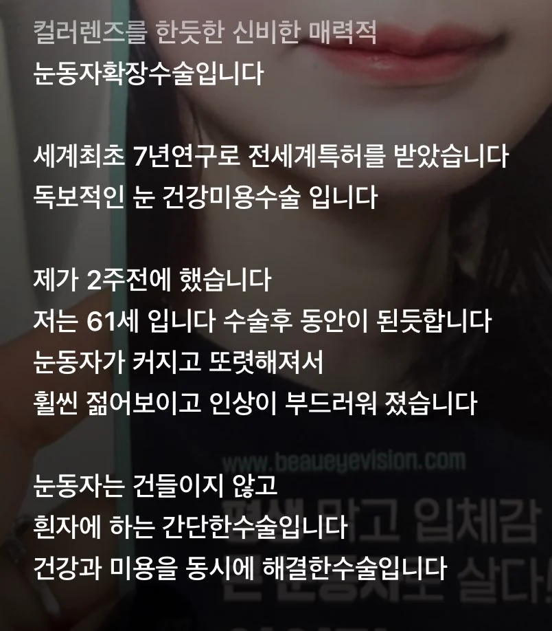 요즘 홍보중인 눈동자 성형수술...jpg | 인스티즈
