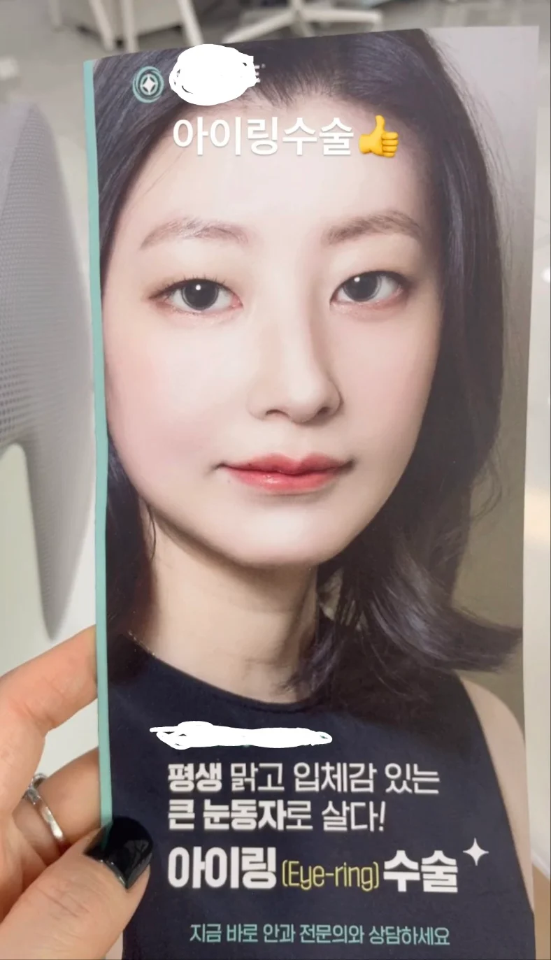 요즘 홍보중인 눈동자 성형수술...jpg | 인스티즈