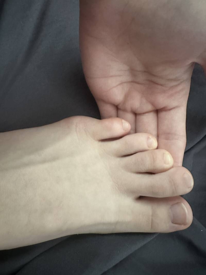 [잡담] 나 새끼발가락이 너무 부었는데 이게 뭐지 병원가야되나? ㅎㅇㅈㅇ | 인스티즈