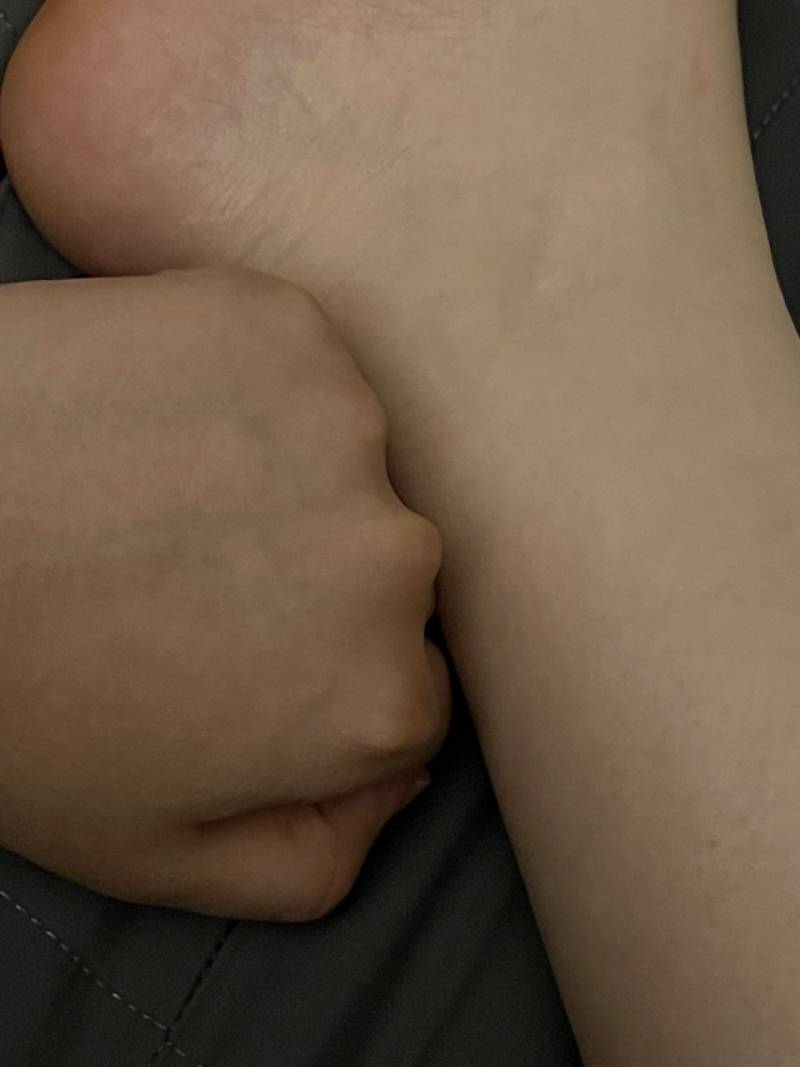 [잡담] 옛날에 탄 피부 복구 안 되지ㅠㅠ? | 인스티즈