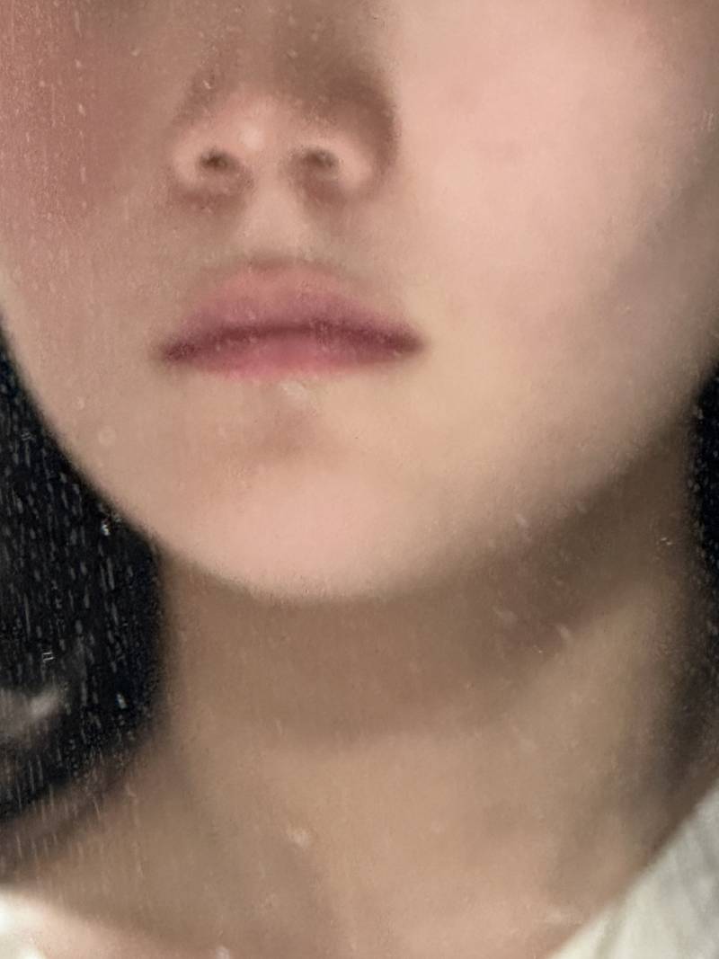 [잡담] 입술필러 추천 비추천? | 인스티즈