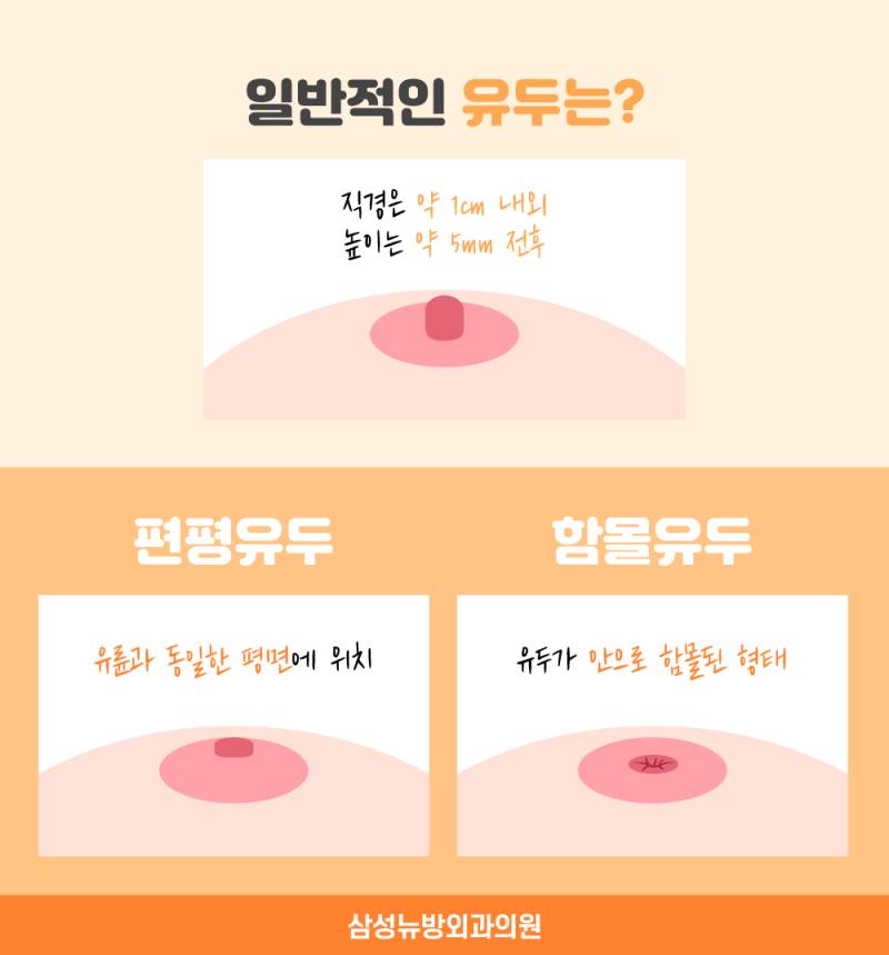 [잡담] 엥 이가 내가 쓴글은 아닌데 궁금해서 아니 보통 가슴이 튀어나와있어? 링크사진은 좀 후방일수도 | 인스티즈