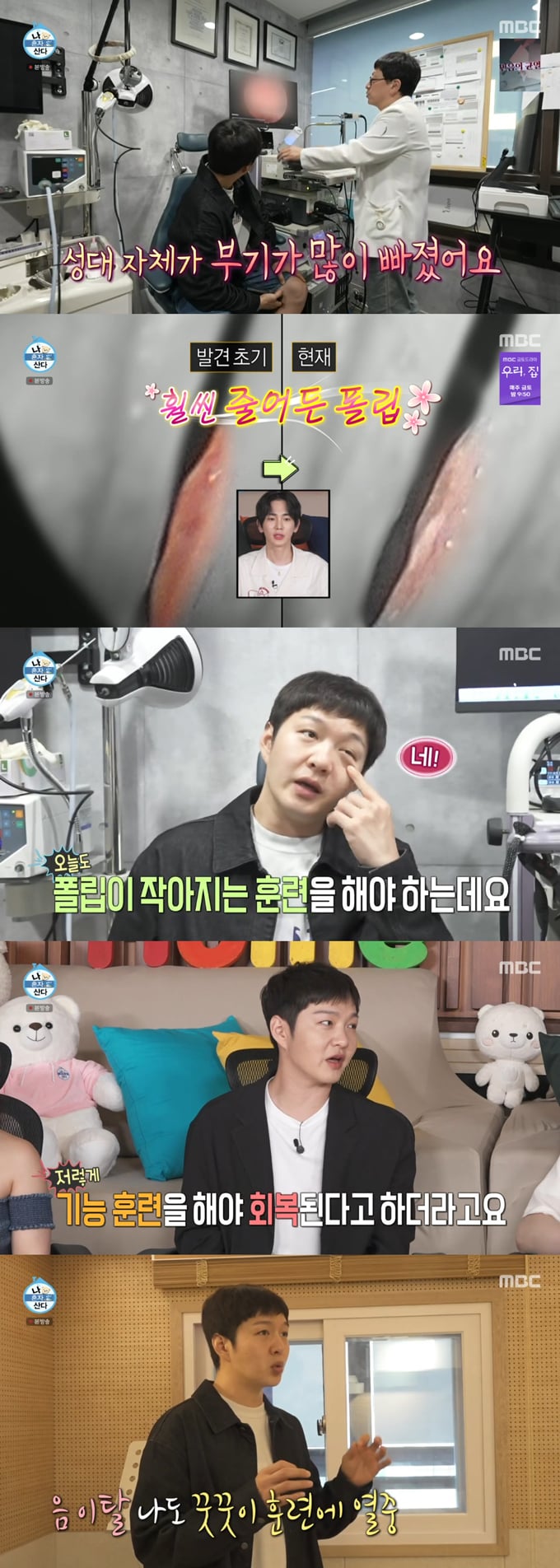 [정보/소식] 이창섭, '성대 폴립'에 목 건강 비상…"노래 못하면 어떡하나" | 인스티즈