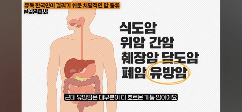 [잡담] 요즘 유방암 난소암 많아진 이유 | 인스티즈