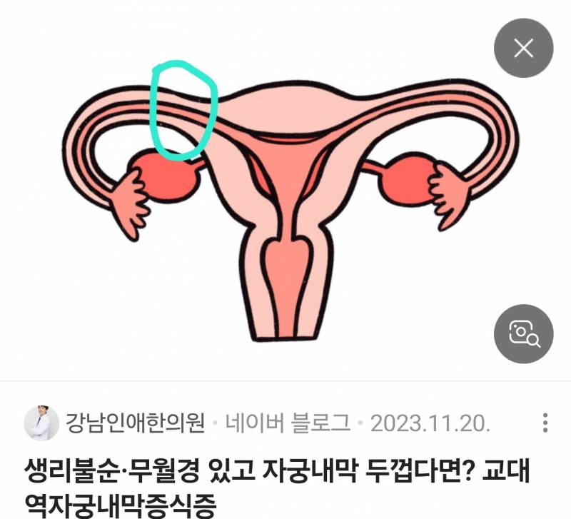 [잡담] 여자들아 | 인스티즈