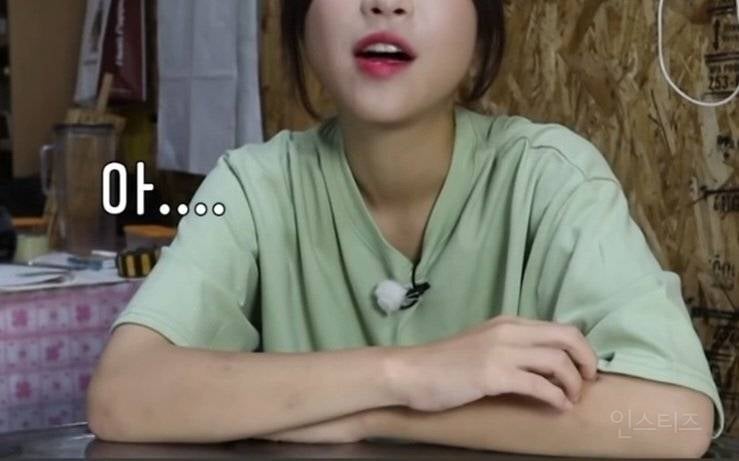이제보니 팔뚝에 멍을 달고 살았던 쯔양.jpg | 인스티즈