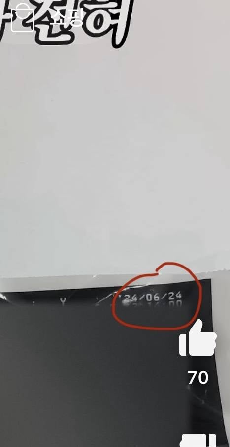 [잡담] 36주 낙태 브이로그 주작 의심 | 인스티즈
