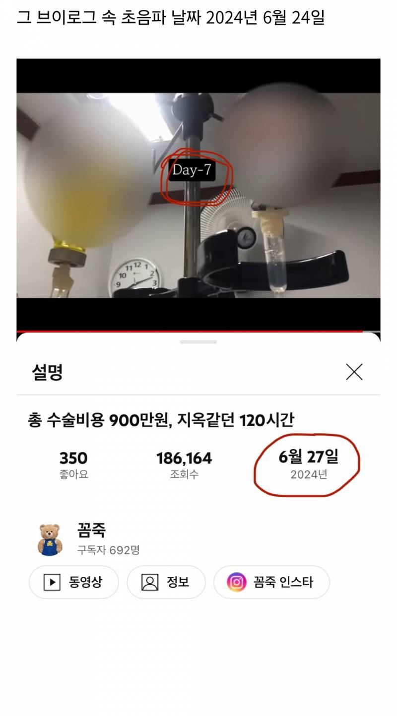 우연히 낙태 허용 주수 정하고 있는 현 상황^^ | 인스티즈