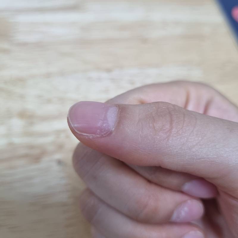 [잡담] 나 손톱이 너무 이상하게 자라는데 이거 왤까???? | 인스티즈