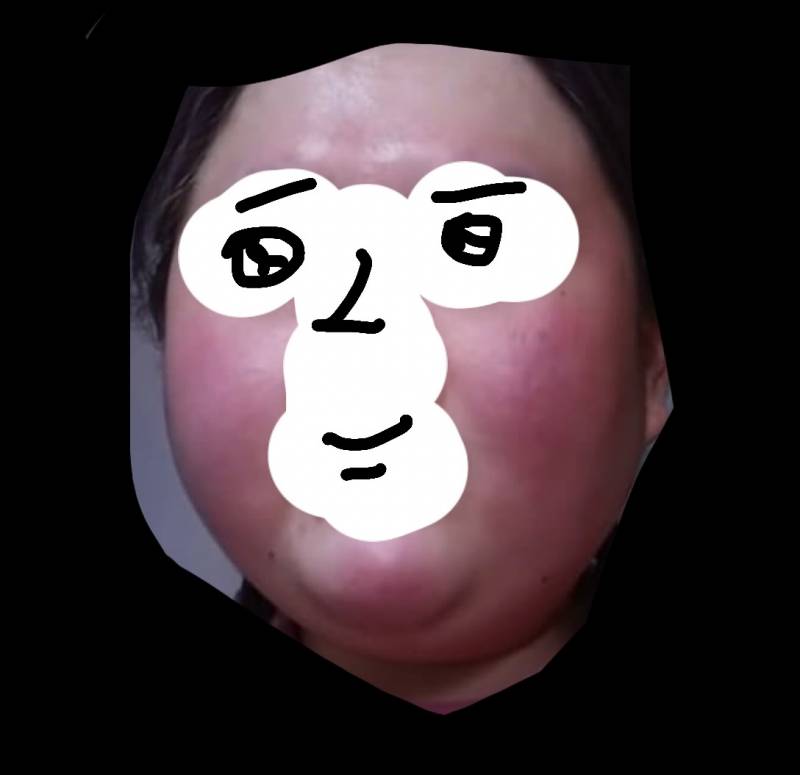 [잡담] 나 피부 너무 홍조 심한가..? | 인스티즈