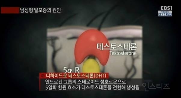 탈모는 유전이 아니다. 그리고 너도 탈모일 수 있다. (저주X 탈모 정보글) | 인스티즈